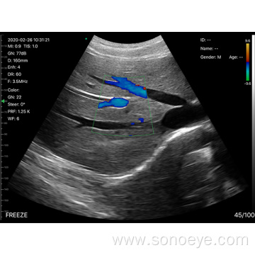 Convex Probe Wireless Mini Ultrasound Scanner